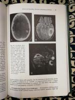 Behavioral Neurology: A Practical Approach Volume 7 (Clinical Neurology and Neurosurgery Monographs)