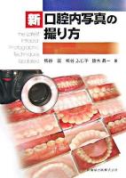 新口腔内写真の撮り方
