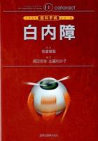 白内障 ＜イラスト眼科手術シリーズ 1＞
