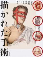 描かれた手術