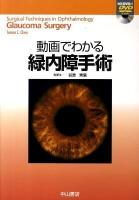 動画でわかる緑内障手術