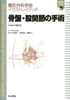 骨盤・股関節の手術 ＜整形外科手術イラストレイテッド / 戸山芳昭 総編集 ; 井樋栄二  黒坂昌弘  高橋和久 編集委員＞