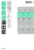 画像でわかる脳脊髄液漏出症