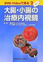 大腸・小腸の治療内視鏡 ＜DVD-Videoで見る 2＞
