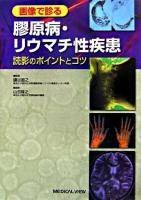 画像で診る膠原病・リウマチ性疾患 : 読影のポイントとコツ