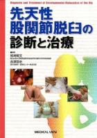 先天性股関節脱臼の診断と治療