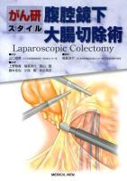 腹腔鏡下大腸切除術