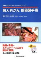 婦人科がん低侵襲手術 : 動画で学ぶエキスパートのテクニック