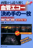 画像から読み解く血管エコー決め手の一枚 ＜ステップアップエコーシリーズ 01＞
