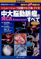 中大脳動脈瘤MCA Aneurysmのすべて ＜ 部位別に学ぶ脳動脈瘤シリーズ＞