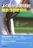 よくわかる野球肘離断性骨軟骨炎 : 肘実践講座