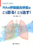 RAの呼吸器合併症はこう診る!こう治す! : Expert eyes