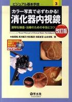 カラー写真で必ずわかる!消化器内視鏡 : 適切な検査・治療のための手技とコツ ＜ビジュアル基本手技 3＞ 改訂版.