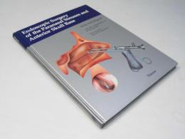 Endoscopic Surgery of the Paranasal Sinuses and Anterior Skull Base
