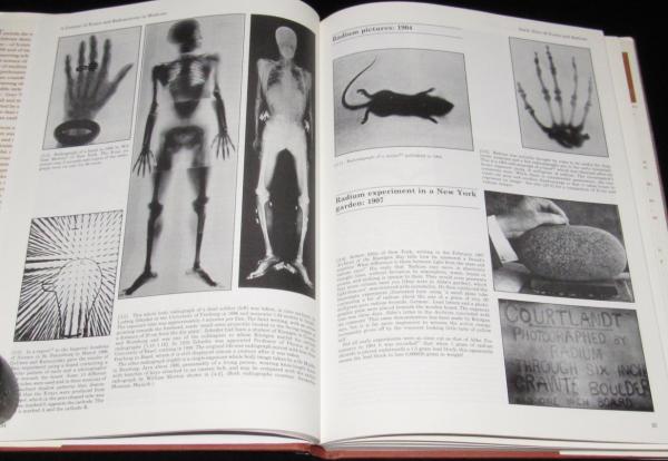 洋書】A Century of X-Rays and Radioactivity in Medicine X線 洋書】A Century of X-Rays and Radioactivity in Medicine X線