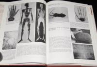 【洋書】A Century of X-Rays and Radioactivity in Medicine　X線と放射能の世紀