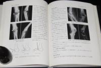 骨折治療の実際　元ビニカバ付き