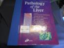 Pathology of the Liver　ハードカバー