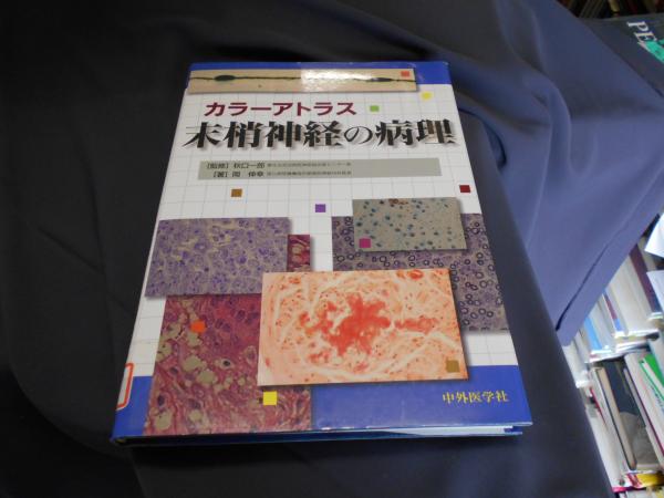 カラーアトラス末梢神経の病理 [大型本] 岡 伸幸; 秋口 一郎