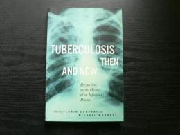 Tuberculosis then and now : perspectives on the history of an infectious disease