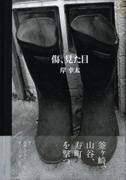 傷、見た目