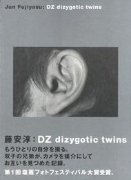 DZ dizygotic twins