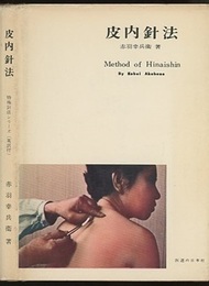 皮内針法  