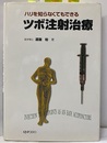ハリをしらなくてもできる　ツボ注射治療  