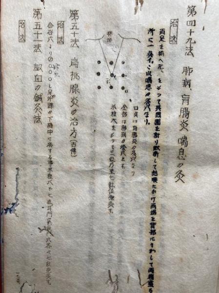 秘鍼名灸秘伝集 各地家伝 | 柳谷素霊編 | 鍼灸受験と古典研究社