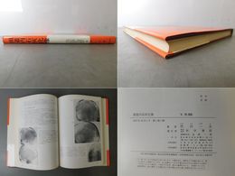 頭蓋内石灰化像