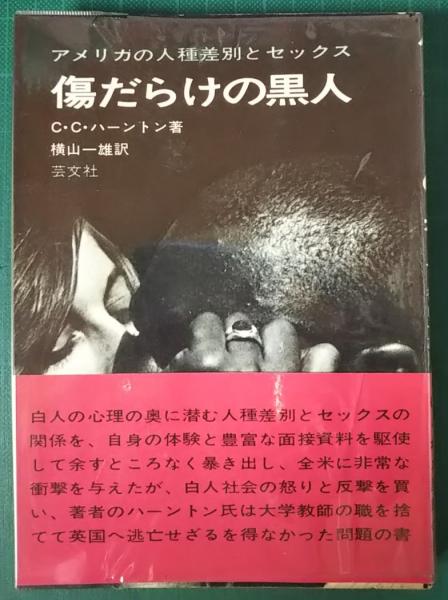 差別 種 アメリカ 人