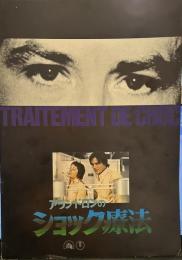 アラン・ドロンのショック療法