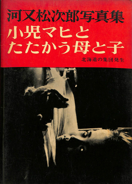 研光社 河又松次郎写真集 小児マヒとたたかう母と子 北海道の集団発生 1961 007s6D 河又松次郎写真集 小児マヒとたたかう母と子 北海道の集団発生(河又
