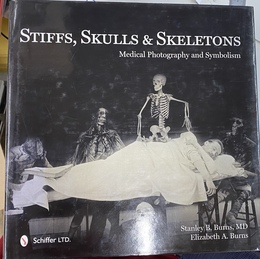 硬直、頭蓋骨、骨格　医療写真と象徴主義　（英）　Stiffs, Skulls & Skeletons: Medical Photography and Symbolism