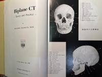 Biplane CT―その基礎と臨床