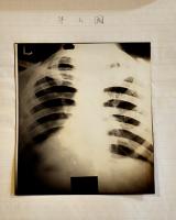 戦闘機搭乗者ノ尿及胸部ノ所見ヨリ観タル加速度ノ影響ニ就テ　大湊海軍航空隊　昭和11年