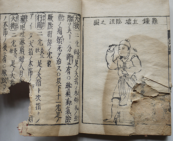 図解改正灸法口訣指南(全4巻揃い)鍼灸経穴図多数入 江戸末頃 図解改正灸法口訣指南(全4巻揃い)鍼灸経穴図多数入 江戸末頃
