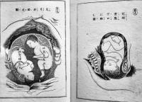子育必携産育造化機論　浅利保正編輯　銅版絵入本　ボール表紙　明治刊