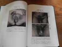 性の健康医学財団　創立100周年記念誌　創立1921年10月22日　花柳病　ころばぬ先に杖　肉体の防衛　アイヌ微毒性骨変化　稀有な微毒　戊戌会　東大皮膚科関連写真ほか
 公益財団法人　性の健康医学財団
    出版社 公益財団法人　性の健康医学財団
    刊行年 2022
    ページ数 652頁
    サイズ 縦27ｃｍ 

財団100年の歴史を振り返る
1921（大正10）年10月22日に財団法人 日本性病予防協会として内務省から法人格の認可を受けて以来100年。
性感染症の認知、啓発活動から、性の健康の増進まで対象範囲を広めた財団の活動の集大成。 
    第１編　沿革
    第２編　回顧と随想
    第３編　活動と記録
    第４編　「體性」の興味ある論考・随筆抜粋
    第５編　機関誌「體性」に掲載された興味ある黴毒症例抜粋
    第６編　関連団体に残る写真および著作
    第７編　性の健康医学財団　主要論文
    第８編　創立100周年記念式典および祝賀会
