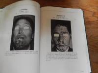 性の健康医学財団　創立100周年記念誌　創立1921年10月22日　花柳病　ころばぬ先に杖　肉体の防衛　アイヌ微毒性骨変化　稀有な微毒　戊戌会　東大皮膚科関連写真ほか
 公益財団法人　性の健康医学財団
    出版社 公益財団法人　性の健康医学財団
    刊行年 2022
    ページ数 652頁
    サイズ 縦27ｃｍ 

財団100年の歴史を振り返る
1921（大正10）年10月22日に財団法人 日本性病予防協会として内務省から法人格の認可を受けて以来100年。
性感染症の認知、啓発活動から、性の健康の増進まで対象範囲を広めた財団の活動の集大成。 
    第１編　沿革
    第２編　回顧と随想
    第３編　活動と記録
    第４編　「體性」の興味ある論考・随筆抜粋
    第５編　機関誌「體性」に掲載された興味ある黴毒症例抜粋
    第６編　関連団体に残る写真および著作
    第７編　性の健康医学財団　主要論文
    第８編　創立100周年記念式典および祝賀会
