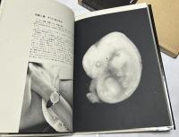 小さな生命 フォート・ドキュメント その死と生と Photographic Document : The Tiniest Life
