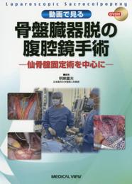 動画で見る 骨盤臓器脱の腹腔鏡手術?仙骨腟固定術を中心に