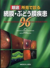 眼底所見で診る 網膜・ぶどう膜疾患96