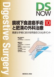 鏡視下食道癌手術と肥満の外科治療?高度な手術における手技のコツとポイント (DS NOW 10)