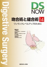 吻合術と縫合術?ワンランクレベルアップのために (DS NOW 14)