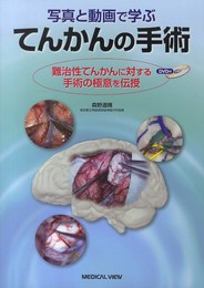 写真と動画で学ぶ てんかんの手術 [DVD付]