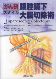 がん研スタイル 腹腔鏡下大腸切除術