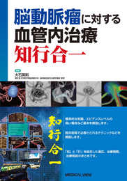 脳動脈瘤に対する血管内治療 知行合一