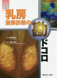 新 乳房画像診断の勘ドコロ