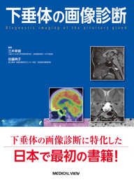 下垂体の画像診断